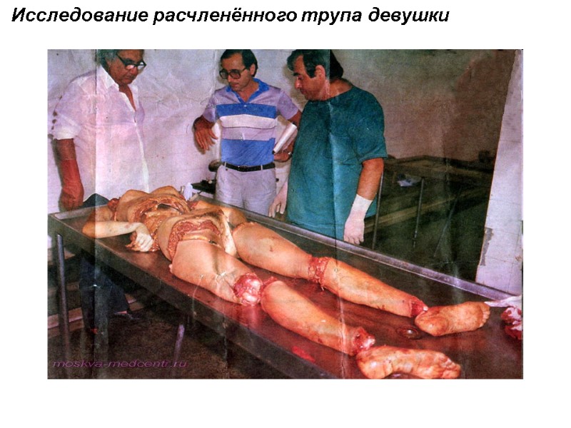 Исследование расчленённого трупа девушки